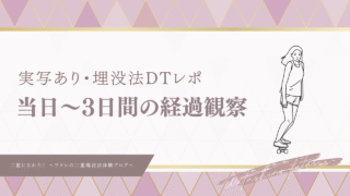 【実録】埋没法ダウンタイム経過レポ：二重整形当日〜3日間編